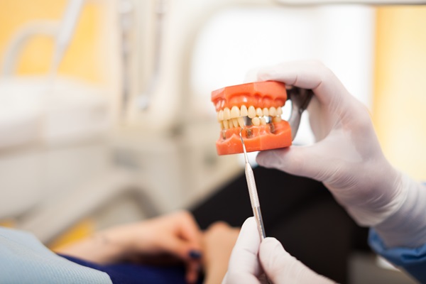 Ask A Dentist: How Do I Prepare For A Dental Bridges Procedure?