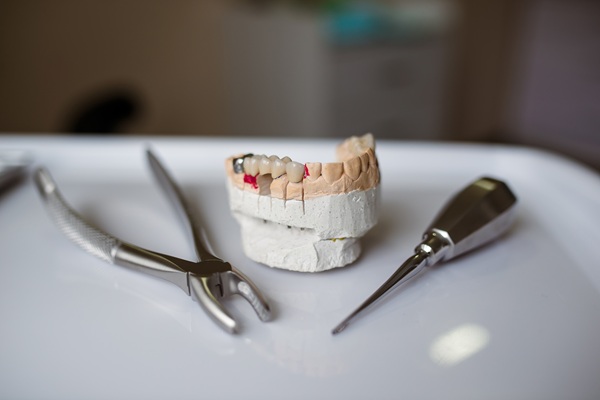 When To Consider A Full Mouth Reconstruction